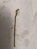 Did I Just Poop out a Worm?
